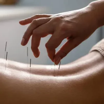 friskvård akupunktur